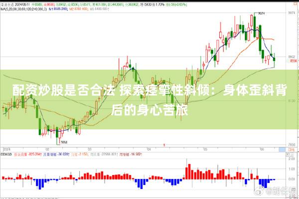 配资炒股是否合法 探索痉挛性斜倾：身体歪斜背后的身心苦旅